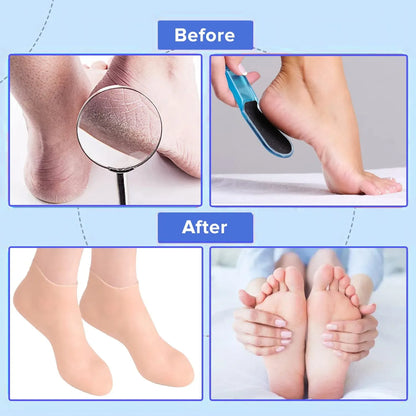 IMPORTED QUALITY Silicone Gel Moisturizing Socks Prevent Foot Heel Crack Shoes
